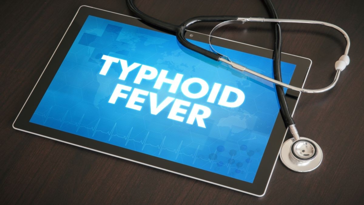 5 Home Remedies For Typhoid