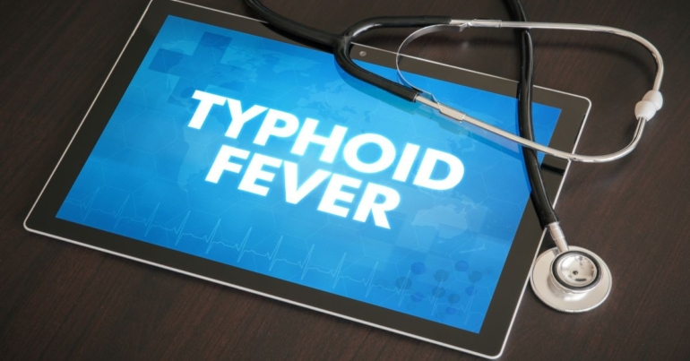 5 Home Remedies For Typhoid